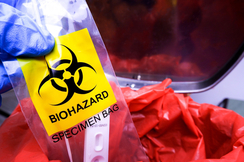 Tại Sao 121 Độ C Là Nhiệt Độ Hấp Tiệt Trùng Tiêu Chuẩn?