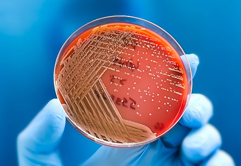 Môi Trường Nuôi Cấy Vi Sinh Là Gì? Định Nghĩa, Phân Loại Môi Trường Nuôi Cấy Vi Sinh