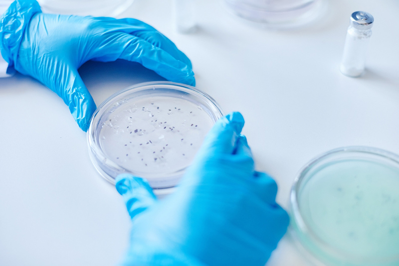 Nuôi Cấy Vi Sinh Vật Là Gì? Ý Nghĩa, Quy Trình, Phân Loại Phương Pháp Nuôi Cấy Vi Sinh Phổ Biến
