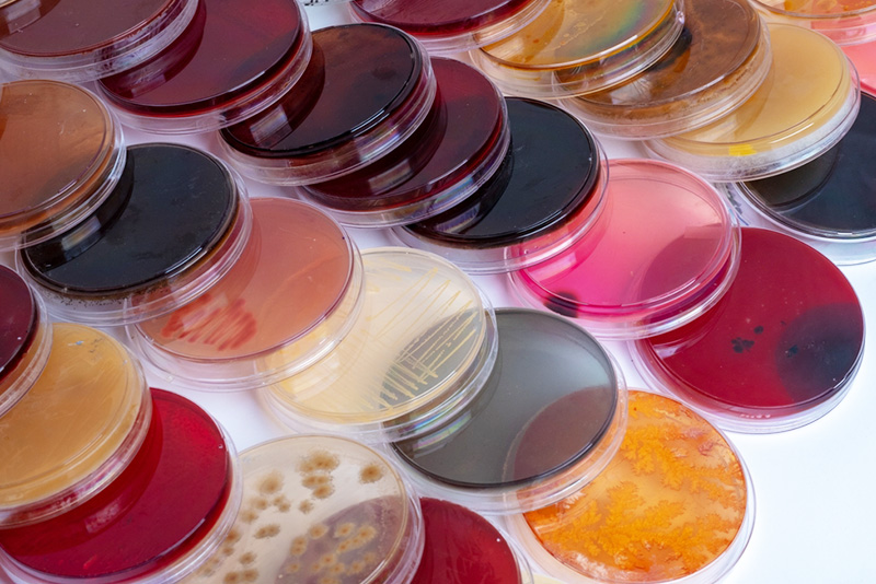 Nuôi Cấy Vi Sinh Vật Là Gì? Ý Nghĩa, Quy Trình, Phân Loại Phương Pháp Nuôi Cấy Vi Sinh Phổ Biến