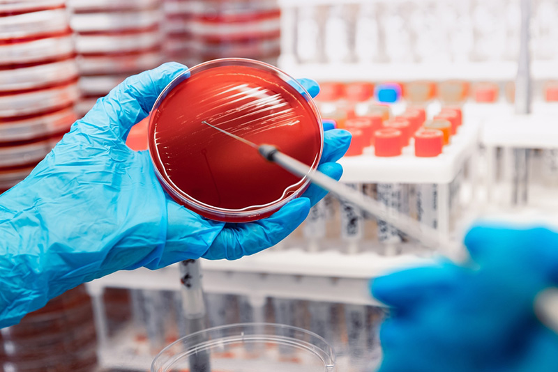 Nuôi Cấy Vi Sinh Vật Là Gì? Ý Nghĩa, Quy Trình, Phân Loại Phương Pháp Nuôi Cấy Vi Sinh Phổ Biến